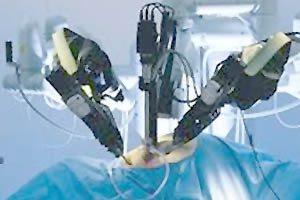 Удаление рака простаты роботом да винчи - стоимость операции в германии